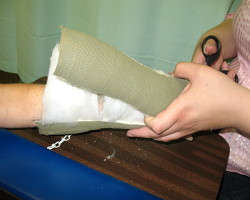 Plaster cast